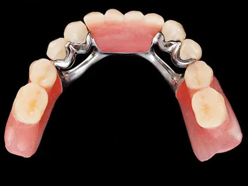 Complete Chrome cobalt lower denture with teeth with black background