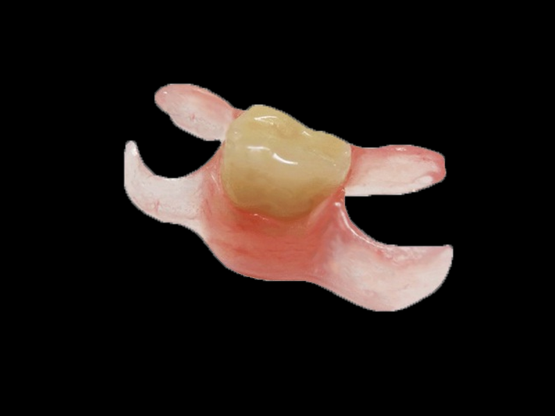 Single tooth flexible denture in black background