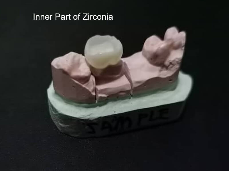 zirconia-crown-inner-part